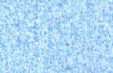N1018-76